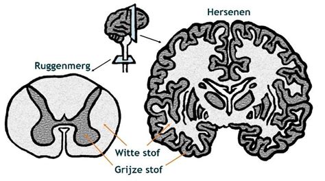 Hersenscan die de hippocampus en grijze stof toont
