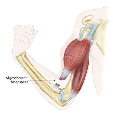 Anatomie van de bicepspees bij de elleboog