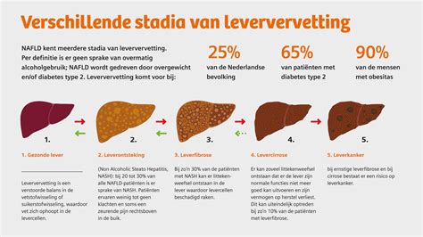 MRI-scan van spieren met indicatie van vervetting