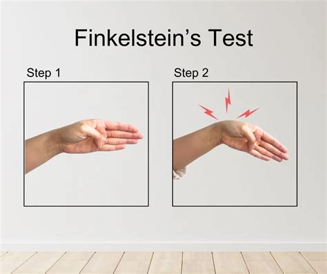 Uitvoering van de Finkelstein test