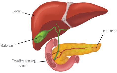 Diagram van de galblaas, lever en galwegen met mogelijke galstenen