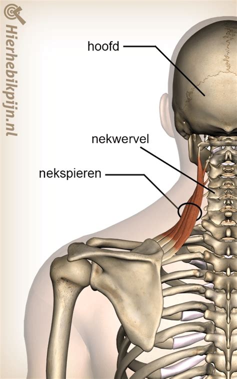Anatomie van de nek met een hernia