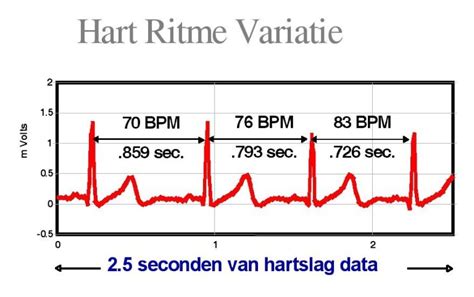 Grafiek die de hartslag tijdens een inspanningstest weergeeft