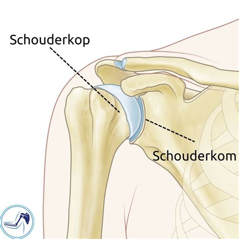 Focus op de achterste schouderkop