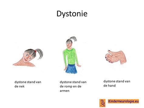 Illustratie van chorea en dystonie bewegingen