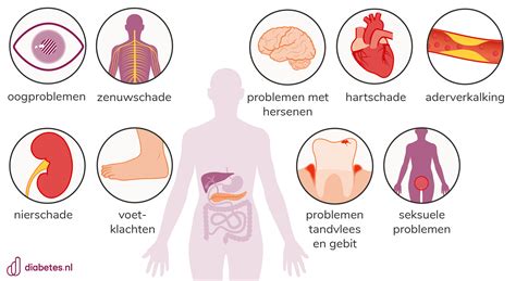 Infographic over de symptomen van een elektrolyten tekort