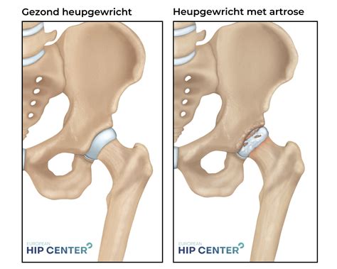 Visualisatie van de juiste heup- en kniehoek bij de hip thrust