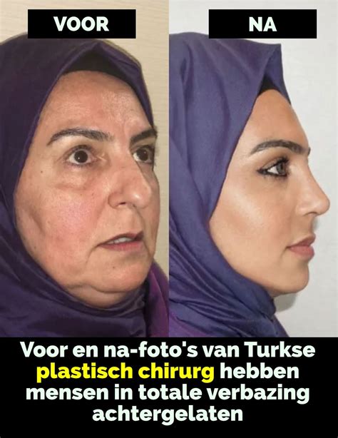 Voor- en na foto's van mensen die fitness doen