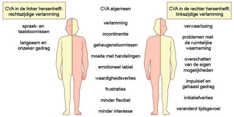 Infographic met verschillende gevolgen van een CVA