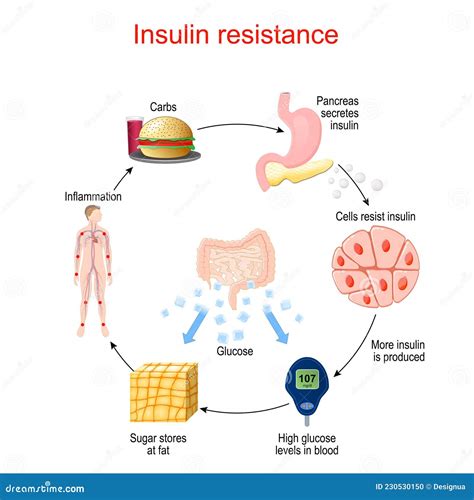 Diagram van insulineresistentie