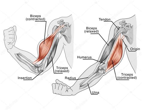Schema van spieren in de arm