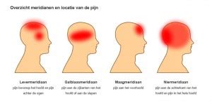 Schema van de oorzaken van hoofdpijn na hardlopen