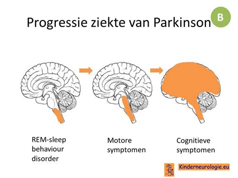 Afbeelding die de progressieve moeilijkheidsgraad van de back extension toont door armpositie